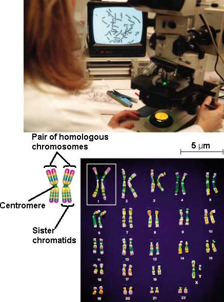 karyotype male. A karyotype is a display of