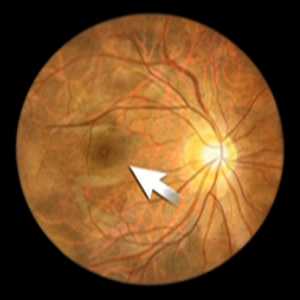 fovea fovea